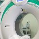 diagnostic-cancer-de-pulmo