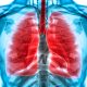 enfermedad pulmonar obstructiva crónica epoc