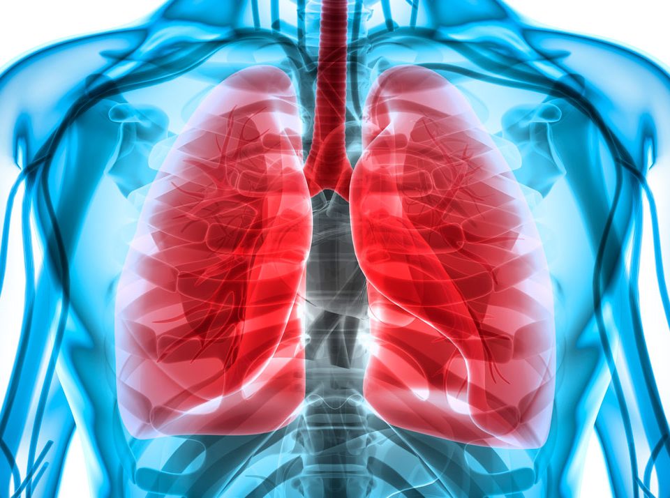 enfermedad pulmonar obstructiva crónica epoc